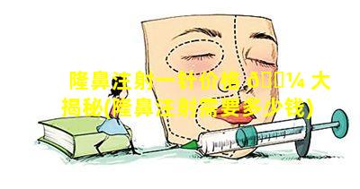 隆鼻注射一针价格 🐼 大揭秘(隆鼻注射需要多少钱)